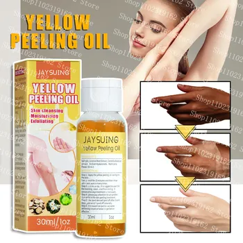 30ml Žlutá Peeling Olej Silný Exfoliační Řešení Bělení Tmavé Skvrny na Kůži Černé tečky na Tělo, Obličej Péče o Pleť Krása